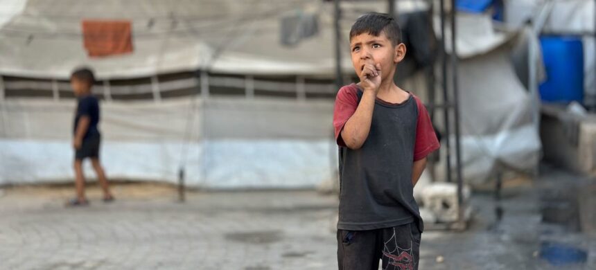 © UNRWA UNRWA teams in Gaza City continue to screen children for malnutrition in Gaza, where a UN-backed food monitoring group has raised alarms about famine.